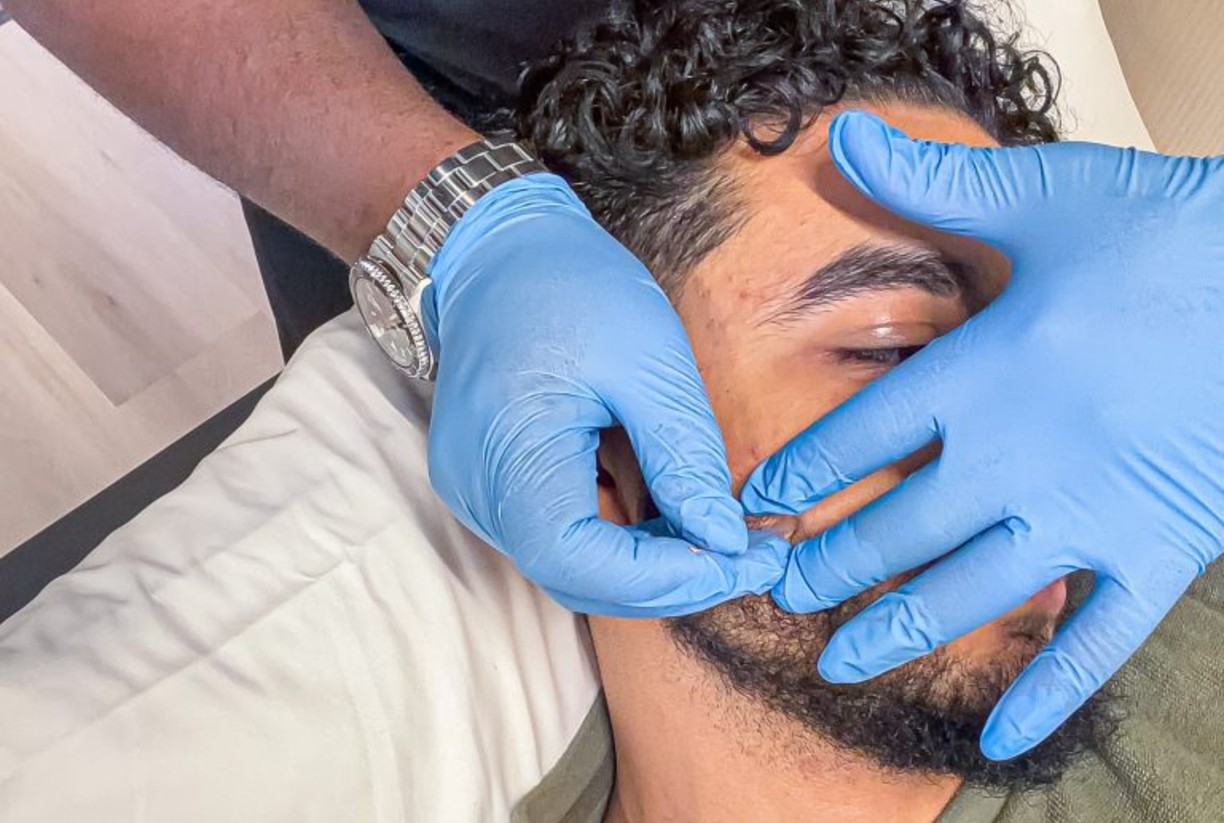 Dry Needling